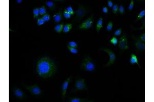 Image provided by One World Lab validation program. (GFAP antibody  (AA 51-150))