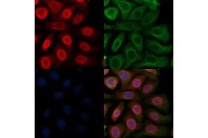 ABIN6262270 and ABIN6277191 staining Hela cells by IF/ICC.
