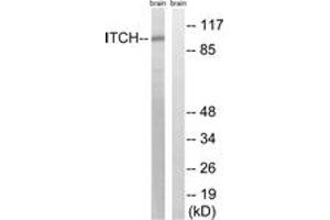 Western blot analysis of extracts from mouse brain cells, using ITCH (Ab-420) Antibody. (ITCH antibody  (AA 386-435))
