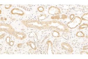 Detection of CDKN1A in Human Kidney Tissue using Polyclonal Antibody to Cyclin Dependent Kinase Inhibitor 1A (CDKN1A) (p21 antibody  (AA 1-164))