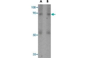 Western blot analysis of CD248 in human colon tissue lysate with CD248 polyclonal antibody  at (A) 0. (CD248 antibody  (N-Term))