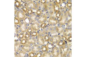 Immunohistochemistry of paraffin-embedded mouse kidney using SMAD9 antibody (ABIN5975592) at dilution of 1/100 (40x lens). (SMAD9 antibody)