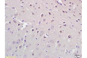 Formalin-fixed and paraffin embedded rat brain labeled with Anti CROT Polyclonal Antibody, Unconjugated (ABIN708896) at 1:200 followed by conjugation to the secondary antibody and DAB staining (CROT antibody  (AA 41-140))