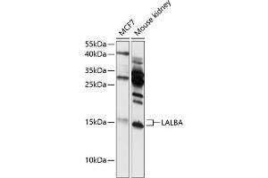 Western blot analysis of extracts of various cell lines, using LALBA antibody (ABIN6130518, ABIN6143065, ABIN6143066 and ABIN6216420) at 1:3000 dilution. (LALBA antibody  (AA 20-142))