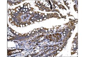 IHC analysis of Prolyl Endopeptidase/PREP using anti-Prolyl Endopeptidase/PREP antibody (ABIN7599118).