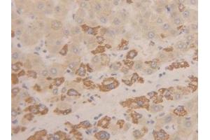 Detection of INHbC in Human Liver Tissue using Polyclonal Antibody to Inhibin Beta C (INHbC) (INHBC antibody  (AA 236-352))