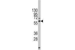 Western Blotting (WB) image for anti-Dystrophin Related Protein 2 (DRP2) antibody (ABIN5014950)