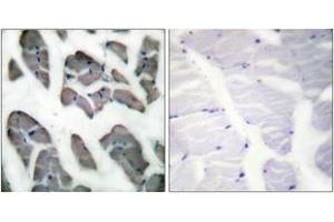Immunohistochemistry analysis of paraffin-embedded human skeletal muscle tissue, using Actin-gamma2 Antibody. (ACTG2 antibody  (AA 1-50))