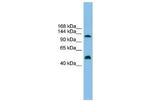 GART antibody used at 1 ug/ml to detect target protein. (GART antibody  (Middle Region))