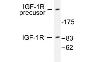 Image no. 1 for anti-Insulin-Like Growth Factor 1 Receptor (IGF1R) antibody (ABIN265475) (IGF1R antibody)