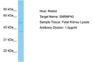 Host: Rabbit Target Name: SNRNP40 Sample Type: Fetal Kidney lysates Antibody Dilution: 1. (SNRNP40 antibody  (Middle Region))