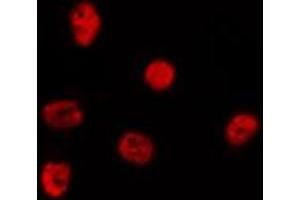 ABIN6278348 staining Hela by IF/ICC. (CHD5 antibody  (Internal Region))