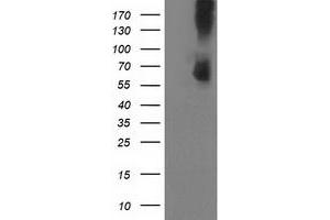 HEK293T cells were transfected with the pCMV6-ENTRY control (Left lane) or pCMV6-ENTRY PDE1B (Right lane) cDNA for 48 hrs and lysed. (PDE1B antibody)