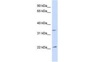 Image no. 1 for anti-ADP-Ribosylation Factor 1 (ARF1) (AA 73-122) antibody (ABIN6747229) (ARF1 antibody  (AA 73-122))