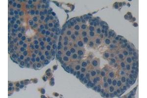 Immunohistochemistry (IHC) image for anti-Leukemia Inhibitory Factor Receptor alpha (LIFR) (AA 382-486) antibody (ABIN7437992)