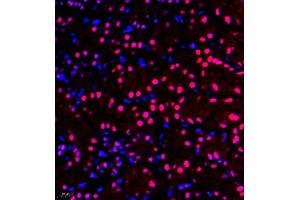 Immunofluorescence of paraffin embedded mouse kidney using ZNF106 (ABIN7076260) at dilution of 1:500 (400x lens) (ZFP106 antibody)