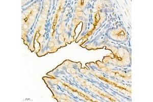 Immunohistochemistry of paraffin embedded mouse colon using CEACAM1 (ABIN7073315) at dilution of 1: 650 (400x lens) (CEACAM1 antibody)