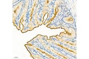 Immunohistochemistry of paraffin embedded mouse colon using CEACAM1 (ABIN7073315) at dilution of 1: 650 (400x lens)