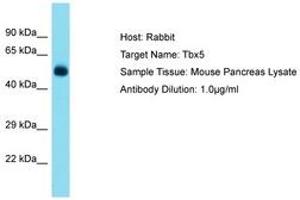 Image no. 1 for anti-T-Box 5 (TBX5) (N-Term) antibody (ABIN6750265) (T-Box 5 antibody  (N-Term))