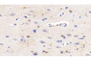 Detection of CK-BB in Human Cerebrum Tissue using Monoclonal Antibody to Creatine Kinase B (CK-BB) (CKB antibody  (AA 11-367))