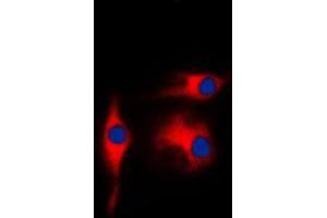 Immunofluorescent analysis of Gamma-enolase staining in K562 cells. (ENO2/NSE antibody  (C-Term))