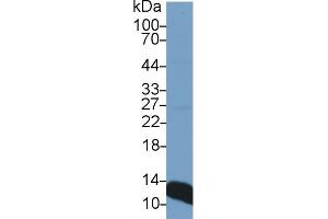 Western Blot; Sample: Rat Liver lysate; Primary Ab: 1µg/ml Rabbit Anti-Rat b2M Antibody Second Ab: 0. (beta-2 Microglobulin antibody  (AA 21-119))