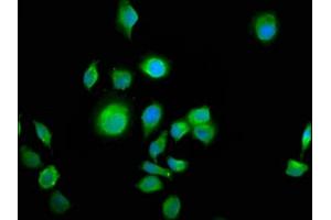 Immunofluorescence staining of A549 cells with ABIN7144052 at 1:100, counter-stained with DAPI. (ALS2CR12 antibody  (AA 26-76))