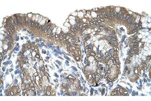 RARRES3 antibody was used for immunohistochemistry at a concentration of 4-8 ug/ml to stain Surface mucous cells and Epithelial cells of fundic gland (arrows) in Human Stomach. (RARRES3 antibody)