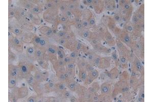 Detection of ASGR1 in Human Liver Tissue using Polyclonal Antibody to Asialoglycoprotein Receptor 1 (ASGR1) (Asialoglycoprotein Receptor 1 antibody  (AA 77-289))