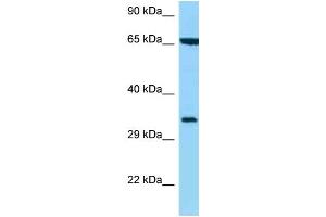 WB Suggested Anti-HLA-C Antibody Titration: 1. (HLA-C antibody  (C-Term))