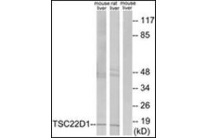 Western blot analysis of extracts from mouse liver/rat liver cells, using TSC22D1 Antibody . (TSC22D1 antibody  (N-Term))