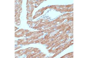 Immunohistochemistry of paraffin-embedded mouse heart using  antibody (ABIN6129863, ABIN6136456, ABIN6136457 and ABIN6215371) at dilution of 1:100 (40x lens). (Acsl3 antibody  (AA 42-300))