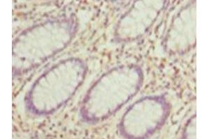 Immunohistochemistry of paraffin-embedded human testis tissue using ABIN7155301 at dilution of 1: 100 (HDAC1 antibody  (AA 1-482))