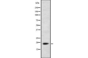 Western blot analysis of FDX1 using HepG2 whole  lysates. (Ferredoxin1 (FDX1) (Internal Region) antibody)