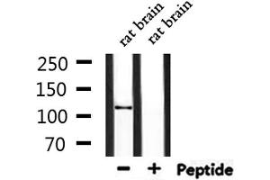 Western blot analysis of extracts from rat brain, using CEP110 Antibody. (Centriolin antibody)