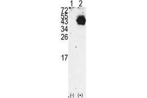 Western blot analysis of PDX1 antibody and 293 cell lysate either nontransfected (Lane 1) or transiently transfected with the PDX1 gene (2). (PDX1 antibody  (AA 40-69))