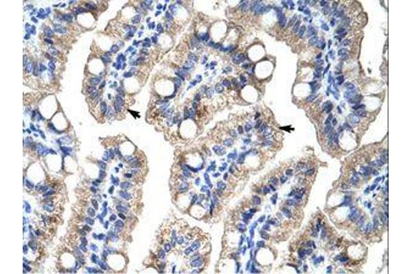 ZNF785 antibody  (C-Term)