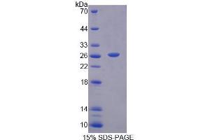SDS-PAGE (SDS) image for Trophinin (TRO) (AA 444-642) protein (His tag) (ABIN4989554) (TRO Protein (AA 444-642) (His tag))
