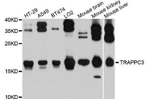 Western blot analysis of extracts of various cells, using TRAPPC3 antibody.