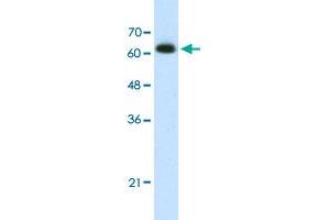 Western Blot analysis of Jurkat cell lysate with DIS3L2 polyclonal antibody  at 1. (DIS3L2 antibody  (N-Term))