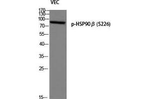 Western Blot (WB) analysis of VEC using p-HSP90beta (S226) antibody. (HSP90AB1 antibody  (pSer226))