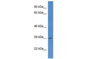Western Blot showing SPSB2 antibody used at a concentration of 1 ug/ml against COLO205 Cell Lysate (SPSB2 antibody  (C-Term))