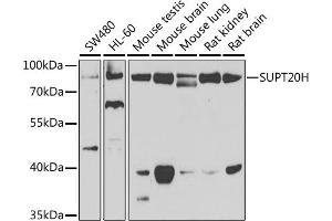 Western blot analysis of extracts of various cell lines, using SUPT20H antibody (ABIN6133386, ABIN6148735, ABIN6148736 and ABIN6223233) at 1:1000 dilution. (FAM48A/P38IP antibody  (AA 580-779))