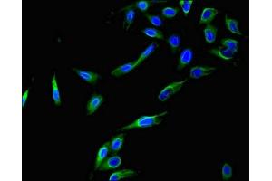 Immunofluorescent analysis of Hela cells using ABIN7148838 at dilution of 1:100 and Alexa Fluor 488-congugated AffiniPure Goat Anti-Rabbit IgG(H+L) (Cyclin C antibody  (AA 240-283))