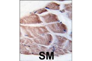 Formalin-fixed and paraffin-embedded human skeletal muscle tissue reacted with RSK3 antibody , which was peroxidase-conjugated to the secondary antibody, followed by DAB staining. (RPS6KA3 antibody  (N-Term))