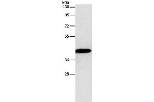 Western Blot analysis of MCF7 cell using Connexin-45 Polyclonal Antibody at dilution of 1:1250 (GJC1 antibody)