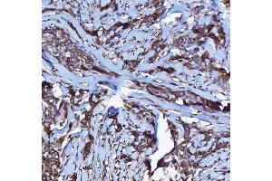 IHC analysis of GPCR RDC1/CXCR-7/ACKR3 using anti-GPCR RDC1/CXCR-7/ACKR3 antibody (ABIN7602889).