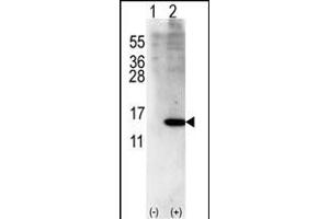 Western blot analysis of ISG15(arrow) using rabbit polyclonal ISG15 Antibody (Center R87) (ABIN387985 and ABIN2844986). (ISG15 antibody  (AA 72-99))