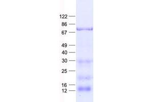 Western Blotting (WB) image for Guanine Nucleotide Binding Protein-Like 3 (Nucleolar) (GNL3) protein (His tag) (ABIN2727716)