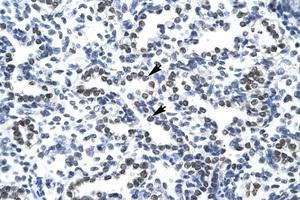 Image no. 1 for anti-Nucleophosmin (Nucleolar phosphoprotein B23, Numatrin) (NPM1) (N-Term) antibody (ABIN202181)